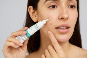 Melhor pomada para espinhas: as 10 melhores em 2025